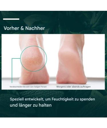  Generisch Foot Cream & Lotions Nourishing Cream for Dry Skin with 50g Soft Moisturizing Cream for Dry Chapped Skin for Men Women Body and Legs - Buy Online on GoSupps.com