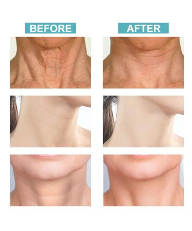 Neck Firming & Tightening Cream for Anti-Aging, Wrinkles, Double Chin & Turkey Neck - Skin Tightener & Crepe Skin Repair - Buy Online on GoSupps.com