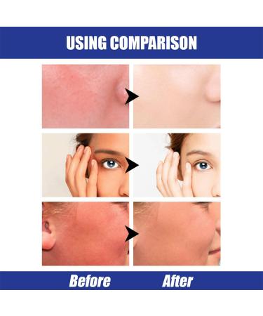 Hyaluronic Acid Natural Sun Cream Hyaluronic Acid Watery Sun Gel Sunscreen SPF 50 Deeply Hydrating Suncream Moisturizing Suncream for Sensitive Skin 50ml - Buy Online on GoSupps.com