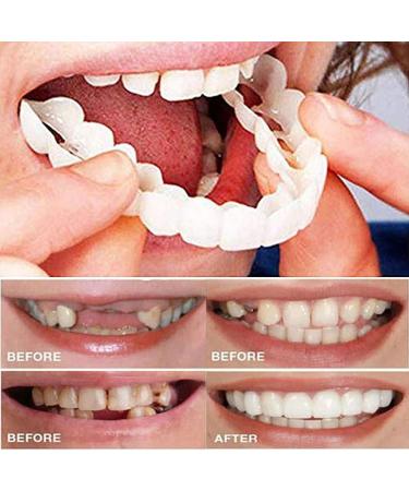 Instant Snap Veneers - Comfortable Flexible Dentures for a Perfect Smile | Top & Bottom Teeth Enhancement - Buy Online on GoSupps.com
