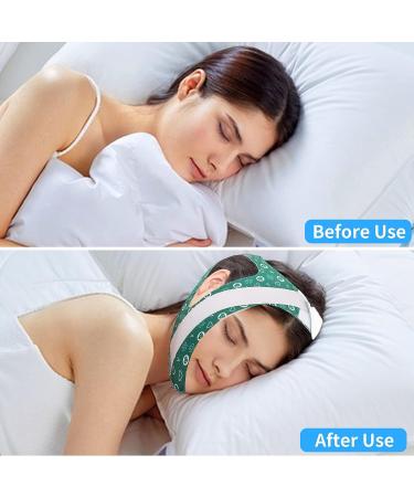 Adjustable Anti-Snoring Chin Strap for Women - Stop Snoring with NXKIDR Chin Strap for Sleeping - Buy Online on GoSupps.com