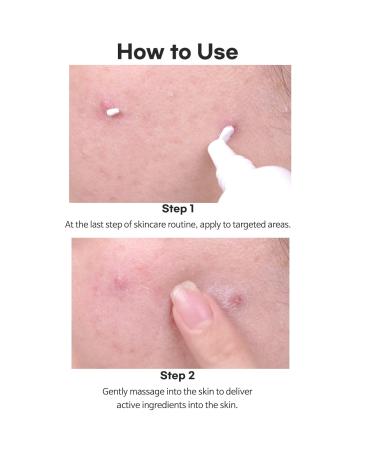 TIAM AC Fighting Spot RX Cream - Best Acne Treatment for Acne-Prone Skin Nourishing & Calming Relief for Red Skin - 1 Oz - Buy Online on GoSupps.com
