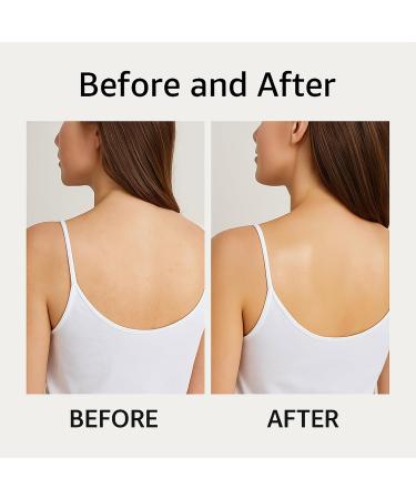 Helbr Lightweight Body Oil for Women Moisturizes & Hydrates Dry Skin Fast-Absorbing After Shower Body Oil Nourishes and Softens with a Light Scent Non-Greasy Formula (2pcs) - Buy Online on GoSupps.com