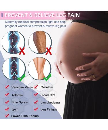 Beister Maternity Medical Compression Tights 20-30mmHg Graduated Support Legging for Pregnancy - Button Elastic, Abdominal Protection, High Waist, Varicosity - Beige - Buy Online on GoSupps.com