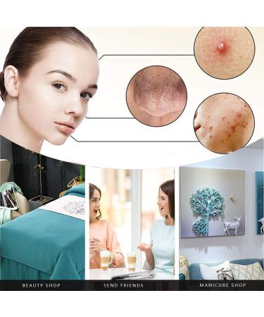 6-Piece Stainless Steel Blackhead Remover Tool Set - Effective Pimple & Blackhead Remover with Case - Buy Online on GoSupps.com