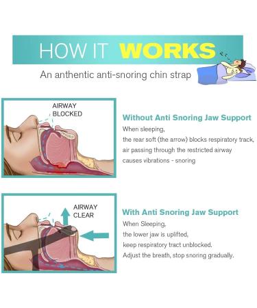 2024 Anti Snoring Chin Strap | Effective Snoring Solution & Equipment for Stubborn Snoring Reduction - Buy Online on GoSupps.com