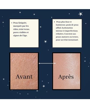 Iriy - Facial Peeling Lotion - Glycolic Acid Peeling - Gentle Exfoliation Immediate Radiance Tightened Pores - Glow Skin Radiant and Smooth Skin - Face Scrub 100 ml - Buy Online on GoSupps.com