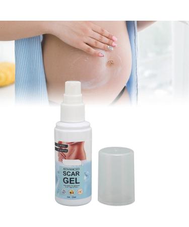 2Pcs Stretch Marks Remover 50ml Scar Gel w/ Allantoin & Vitamin E - Hydrating & Renewing for Scars from Burns & Surgery - Buy Online on GoSupps.com