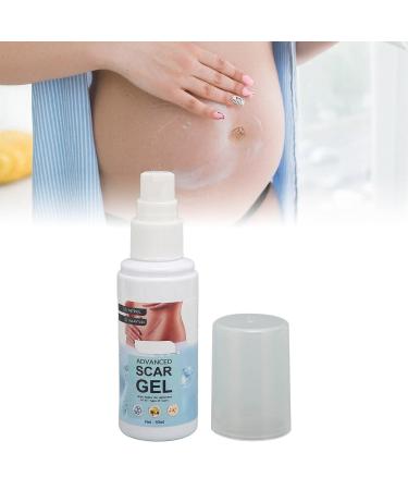 Scar Gel 2Pcs Stretch Marks Remover 50ml - Allantoin & Vitamin E for Hydration and Renewal - Buy Online on GoSupps.com