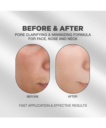 Charcoal Clay Mask for Blackheads and Pores - Peel Off Blackhead Remover with Bamboo Charcoal and Natural Ingredients - Buy Online on GoSupps.com