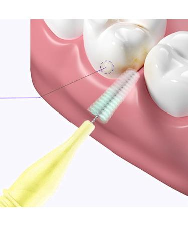 Miokycl Intermediate Brushes for Braces - 0.4mm Ultra-Soft Cleaning Tool | 40 Pack for Adults - Effective Gum Care and Gap Cleaning - Buy Online on GoSupps.com