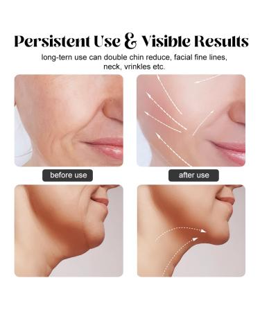 Firming Wrinkle Removal Device | Facial Massager for Neck, Face & Double Chin | LED Heat Modes for Skin Tightening | White - Buy Online on GoSupps.com