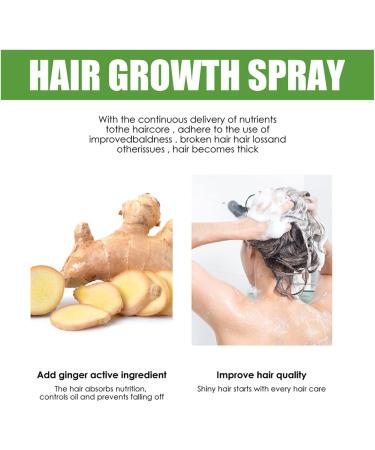 Hair Growth Serum Hair Lotion Hair Loss Treatments for Men Women Promotes Hair Thicker and Stronger Natural Nourishing Hair Growth Spray Hair Care for Dry Damaged Hair. (120ml) - Buy Online on GoSupps.com