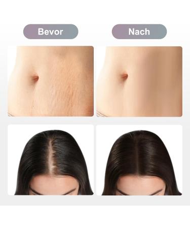  Bestauty Dr. Pen Ultima M8 10-Pack 11-Pin Cartridges for Dr. Pen Ultima M8 Microneedling Pen 100% Original Dr. Pen Ultima M8 Needles 11-Pin Model - Buy Online on GoSupps.com