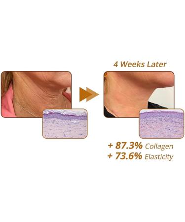 IFFANY Peptide Reversal Serum Peptide WrinkleFilling Essence Collagen Peptide Serum Replenishing Liquid Moisturizing Facial Serum Tightening Sagging Skin Reduce Fine Lines - Buy Online on GoSupps.com