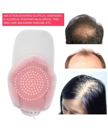 Therapy Alopecia Helmet for Hair Growth | 108 Lamp Beads | Anti-Hair Loss Treatment - International Shipping Available - Buy Online on GoSupps.com