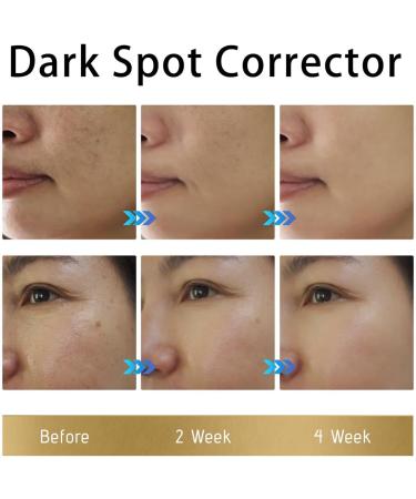 Hydrating Face Moisturizer Hydrating Cream For Firm Calming Day Lotion Repairing Dull Skin Skin Repairing Nourishing Beauty Lotion For Women With Dry Plump Skin - Buy Online on GoSupps.com