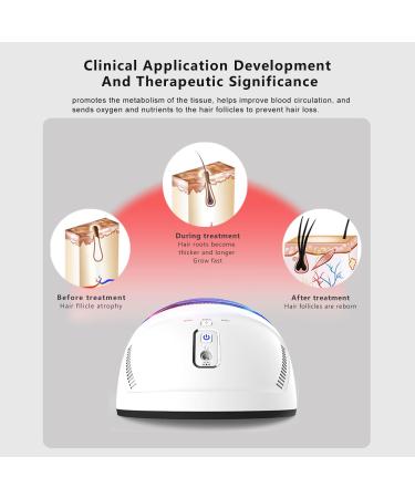 Laser Hair Growth System Cap - FDA Cleared Hair Regrowth Hat for Men & Women | 8000C Laser Therapy - Buy Online on GoSupps.com