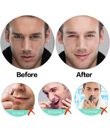 Painless Nose Waxing Kit for Easy Removal of Nose and Nasal Hair - Buy Online on GoSupps.com