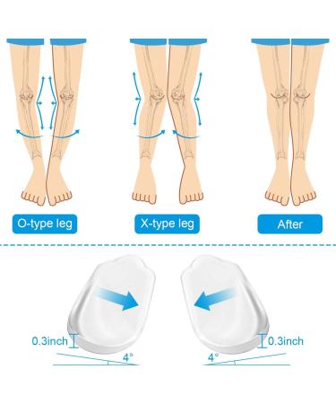 Orthopedic Insoles (4 Pairs) for Men & Women - Lateral Heel Wedges for Corrective Pronation, Supination, O/X Type Legs - Silicone Inserts for Height Increase and Heel Pain Relief - Buy Online on GoSupps.com