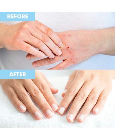 BODIPURE Premium Keratin Gloves - Hydrating & Cuticle Softening Hand Masks for Dry Hands - Anti-Aging Moisturizing Treatment with Natural Ingredients - 4 Pack - Buy Online on GoSupps.com