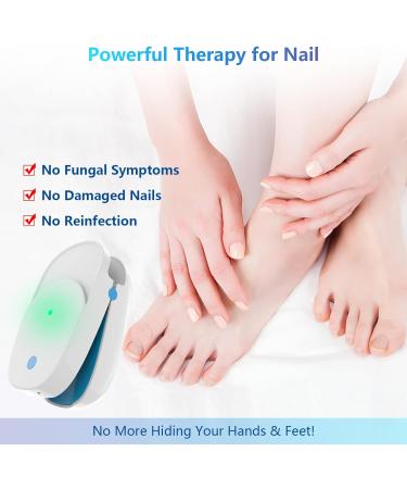iKeener Portable Cold Laser Nail Fungus Treatment - Rechargeable Home Care Device for Painless Onychomycosis Cure - Buy Online on GoSupps.com