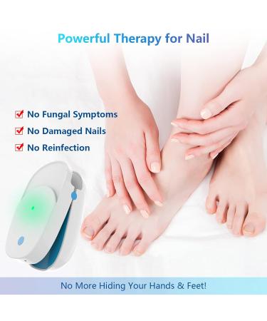 Nail Fungus Laser Treatment Device - Effective Onychomycosis Remover for Home Use | 470nm Blue Light 660nm Red Light 905nm Infrared Light - Buy Online on GoSupps.com