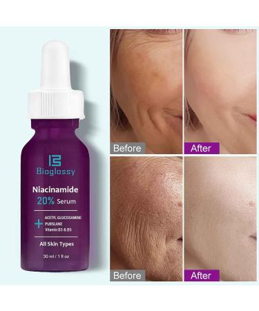 20% Niacinamide Serum | Vitamin B3 Anti-Aging Moisturizer & Pore Minimizer | 30ml Concentrated Treatment - Buy Online on GoSupps.com
