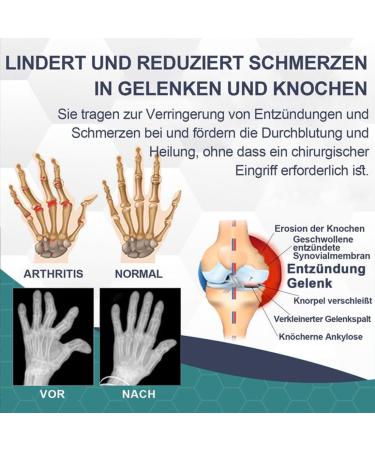 Buy Todahof Bee Venom Ointment & Relief Cream | Effective Pain Relief | International Shipping - Buy Online on GoSupps.com