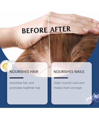 Rubu22a Rosemary oil blueberry hair oil suitable for women and men pure natural cosmetics for hair and scalp nourishing scalp treatment 100 ml 033 ml 300er Pack - Buy Online on GoSupps.com