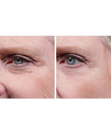 Velform Anti-Aging Eye Cream Lizz - Rejuvenating Anti-Wrinkle Cream for Face Neck & Eye Area | International Shipping Available - Buy Online on GoSupps.com