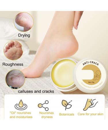Fengyang 2 x Anti-Crack Foot Cream Anti-Tear Cream Anti-Crack Heel Cream Anti Crack Foot Creams for Dry Rough Hands - Buy Online on GoSupps.com