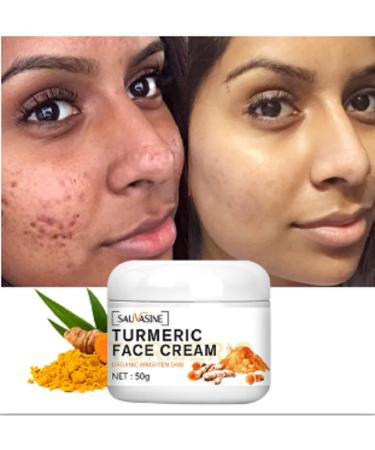 Lanthome Turmeric Face Cream - Anti-Aging Moisturizer for Skin, Acne Treatment, 50g - Buy Online on GoSupps.com