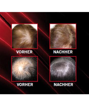 LALabs Hairpro Thick for Gray Hair - Buy Online on GoSupps.com