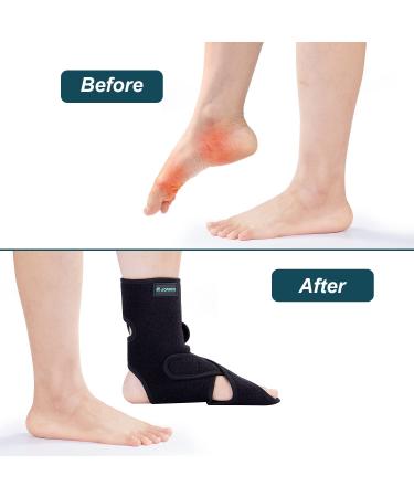 JOMECA Drop Foot Brace with Arch Support | Adjustable AFO for Walking | Medical Grade Orthosis Brace for Lower Limb Instability | MS, TBI, Stroke, Cerebral Palsy, Fracture Relief (Left X-Large) - Buy Online on GoSupps.com