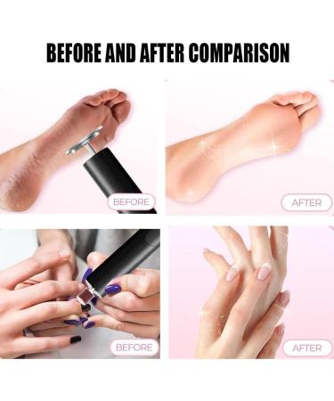Cordless Electric Callus Remover for Feet with Nail File Sander 2 in 1 Rechargeable Foot File Grinder for Dead Skin Crack Dry Calluses with Sandpaper Disk 6 Speed Adjustable Black - Buy Online on GoSupps.com