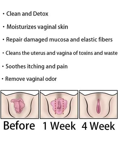 Dexca Natural Detox Repair Capsules - Firming & Pink Vaginal Support | Get in Shape in 3-6 Weeks (A-2Bag) - Worldwide Shipping - Buy Online on GoSupps.com