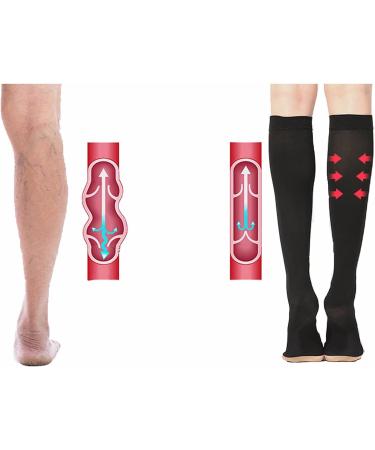 WSYKC Compression Stockings 23-32mmHg | Unisex Varicose Vein Relief | Reduce Swelling & Pain - Buy Online on GoSupps.com