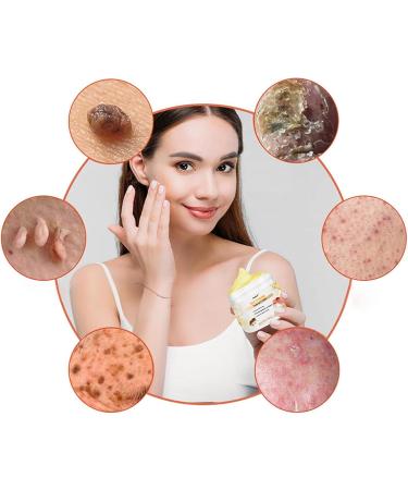 Awzlove Bee Venom Treatment Cream 2024 | Hydrating & Moisturizing Repair Cream for Men & Women - 1 Fl Oz - Buy Online on GoSupps.com