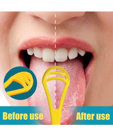 Pack of 4 Tongue Scrapers & Cleaners | Oral Hygiene & Bad Breath Solution for Adults Men Women & Children - Buy Online on GoSupps.com