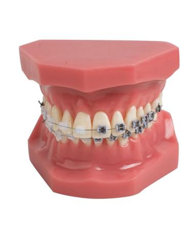 Dental Model Dentist Orthodontic Teeth Demonstration Model Orthodontic Dental Model with Ceramic Brackets and Metal Bracket for Learning Teaching Research