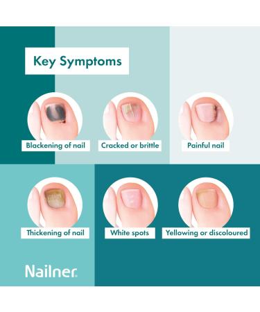 Nailner Active Cover Nail Fungus Treatment - 24 Hour Peel Off Technology - Nude 30ml - Buy Online on GoSupps.com