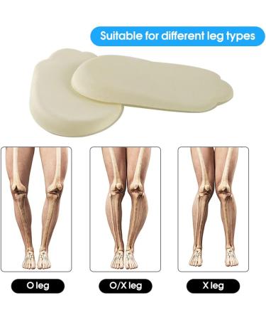 Orthopedic Silicone Gel Heel Wedge Insoles - 2 Pairs | Foot Alignment Support for O/X Leg, Bowlegs and Knock Knees - Buy Online on GoSupps.com