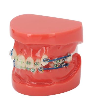 Buy GFRGFH Dental Model with 24 Teeth - Half Metal Half Ceramic Bracket for Teaching & Study - International Shipping Available - Buy Online on GoSupps.com