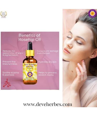  Deve Herbes Deve Herbs Pack of 5 Pure Rosehip Seeds (Rosa rubiginosa) Natural Therapeutic Grade Cold Pressed 100 ml x 5 (16.9 oz) - Buy Online on GoSupps.com