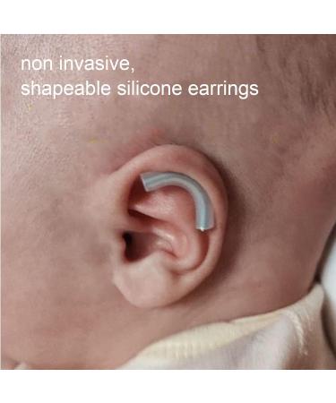 Auricle Valgus Correction Patch - Infant Protruding Ear Gel Tape for Aesthetic Correction - Buy Online on GoSupps.com
