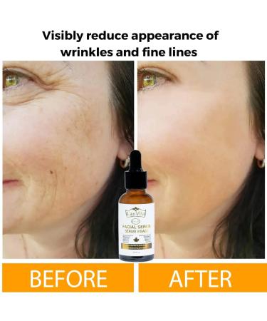 Shop 6 in 1 Vitamin C Face Serum - Anti-Aging with Hyaluronic Acid Retinol & Niacinamide | Brightening & Skin Clearing Serum - Buy Online on GoSupps.com