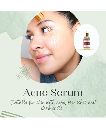 Rose Glow Radiance Face Serum | Vegan Daily Hydration & Anti-Aging Serum for All Skin Types - 15 ml - Buy Online on GoSupps.com