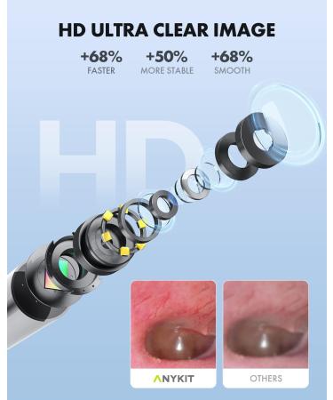 Anykit Wireless Otoscope Ear Camera - Dual View 3.9mm 720PHD WiFi Ear Scope with Ear Wax Removal Tool for Kids, Adults & Pets - Compatible with Android and iPhone - Buy Online on GoSupps.com