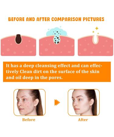 Turmeric Facial Cleanser - Deep Cleansing Foaming Wash for All Skin Types (180g - Buy Online on GoSupps.com